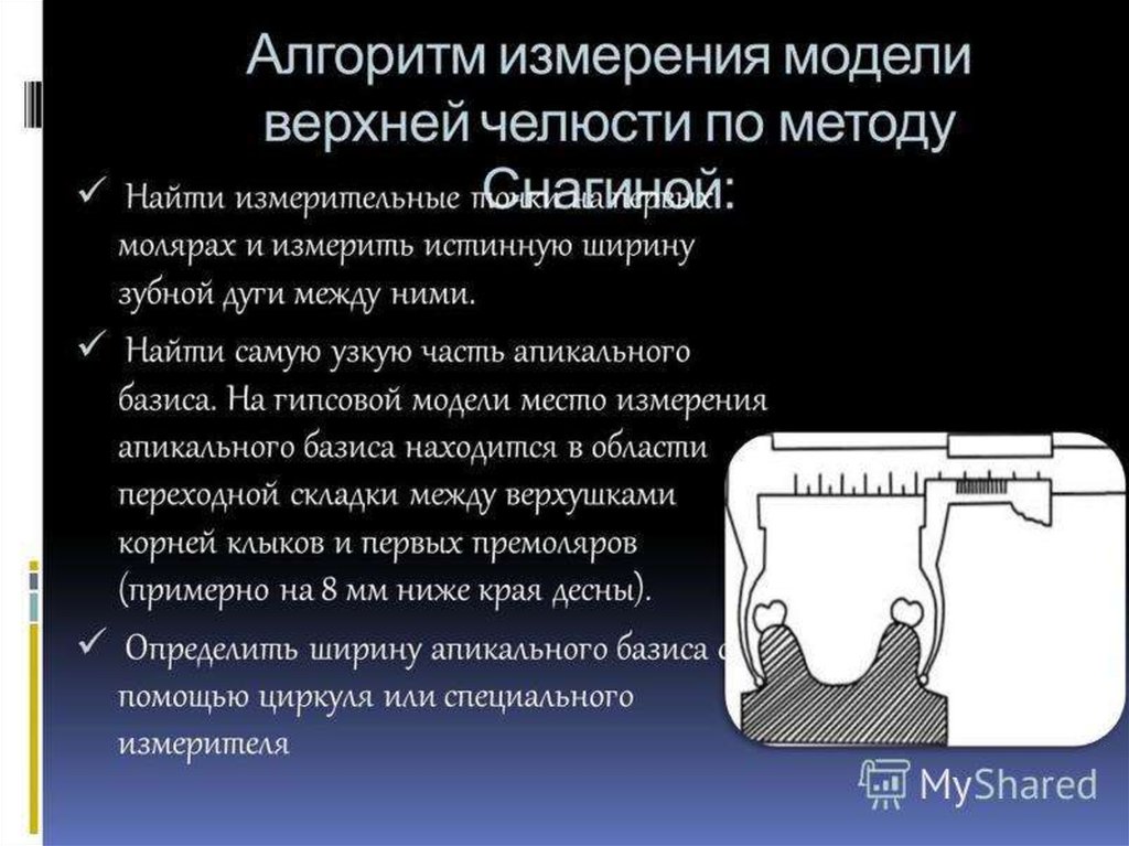 Алгоритм измерения. Биометрия моделей челюстей. Измерение апикального базиса челюстей в ортодонтии. Измерение моделей челюстей по Снагиной. Биометрия ортодонтия.