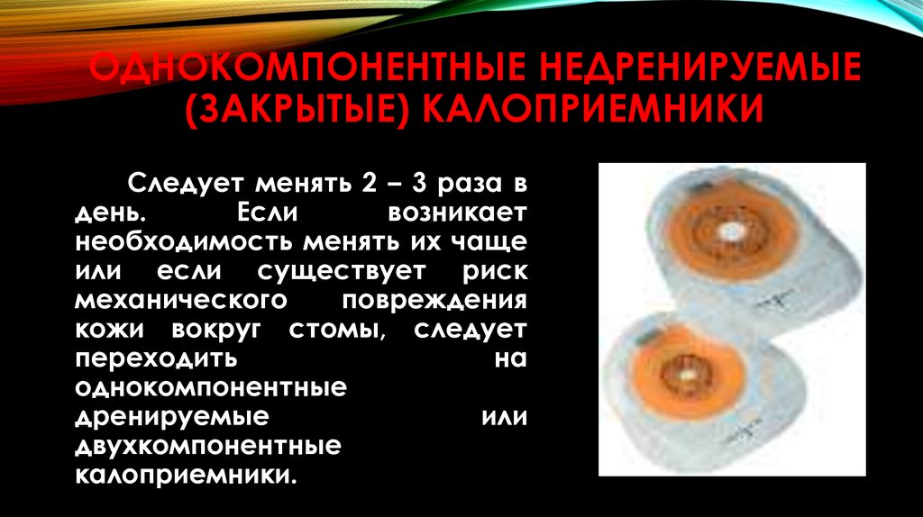 Уход за стомами. Однокомпонентные недренируемые калоприемники. Однокомпонентные недренируемые (закрытые) калоприемники. Дренируемые и недренируемые калоприемники. Двухкомпонентные калоприемники презентация.