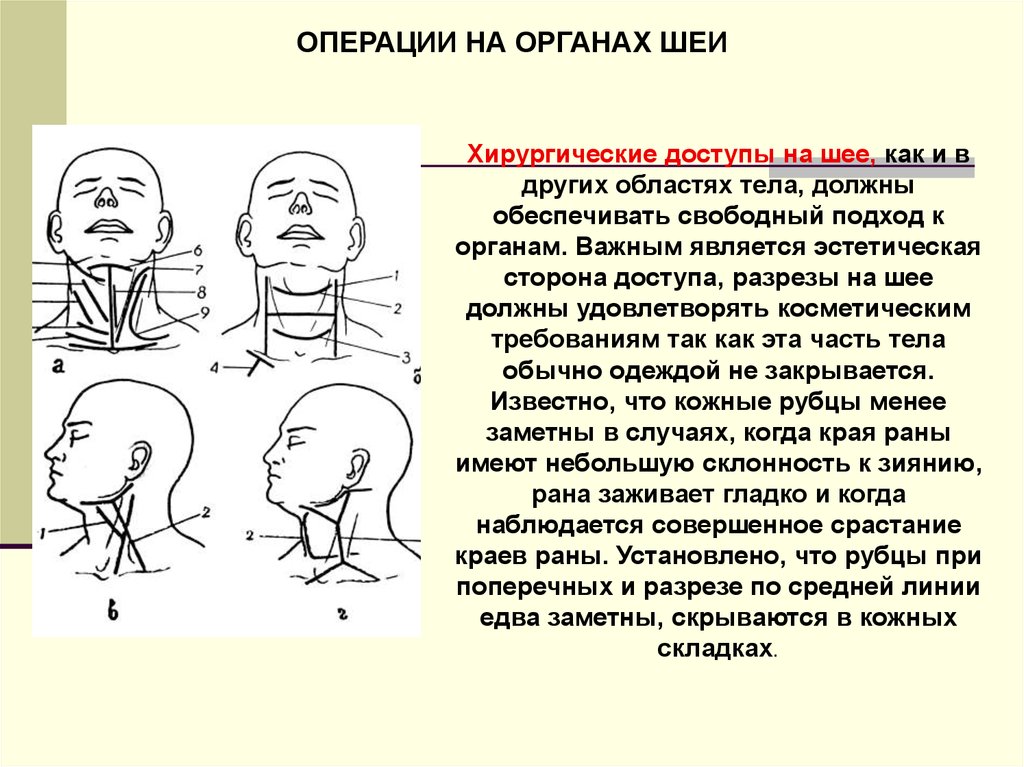 Операция на шею. Оперативные доступы к органам шеи. Хирургические доступы на шее. Хирургические разрезы на шее.