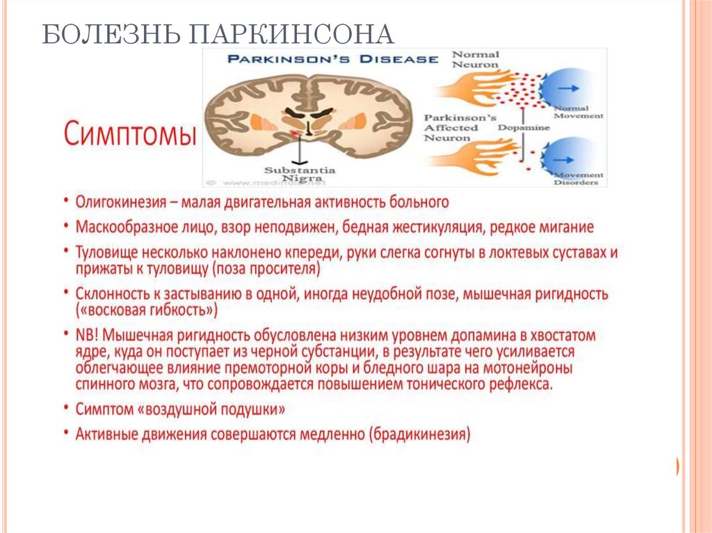 Паркинсон причины. Болезнь Паркинсона симптомы причины. Болезнь Паркинсона причины. Болезнь Паркинсона предпосылки. Паркинсонизм причины возникновения.