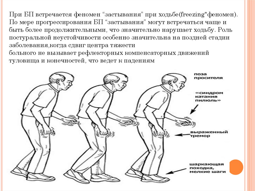 При ходьбе качает и в голове каша