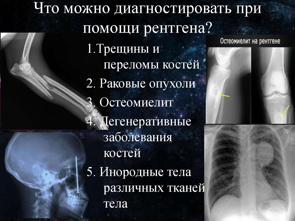 Обычное изображение получаемое при помощи рентгеновских лучей