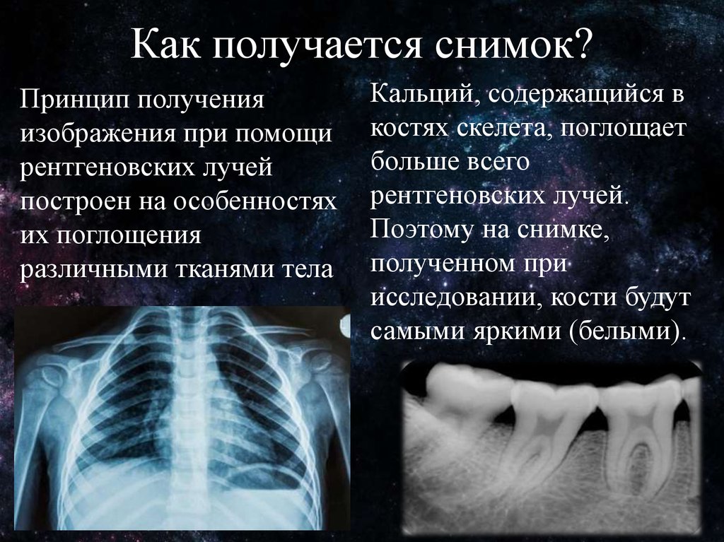 Рентгеновское изображение получают