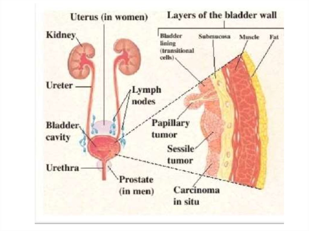 Abnormal Clits