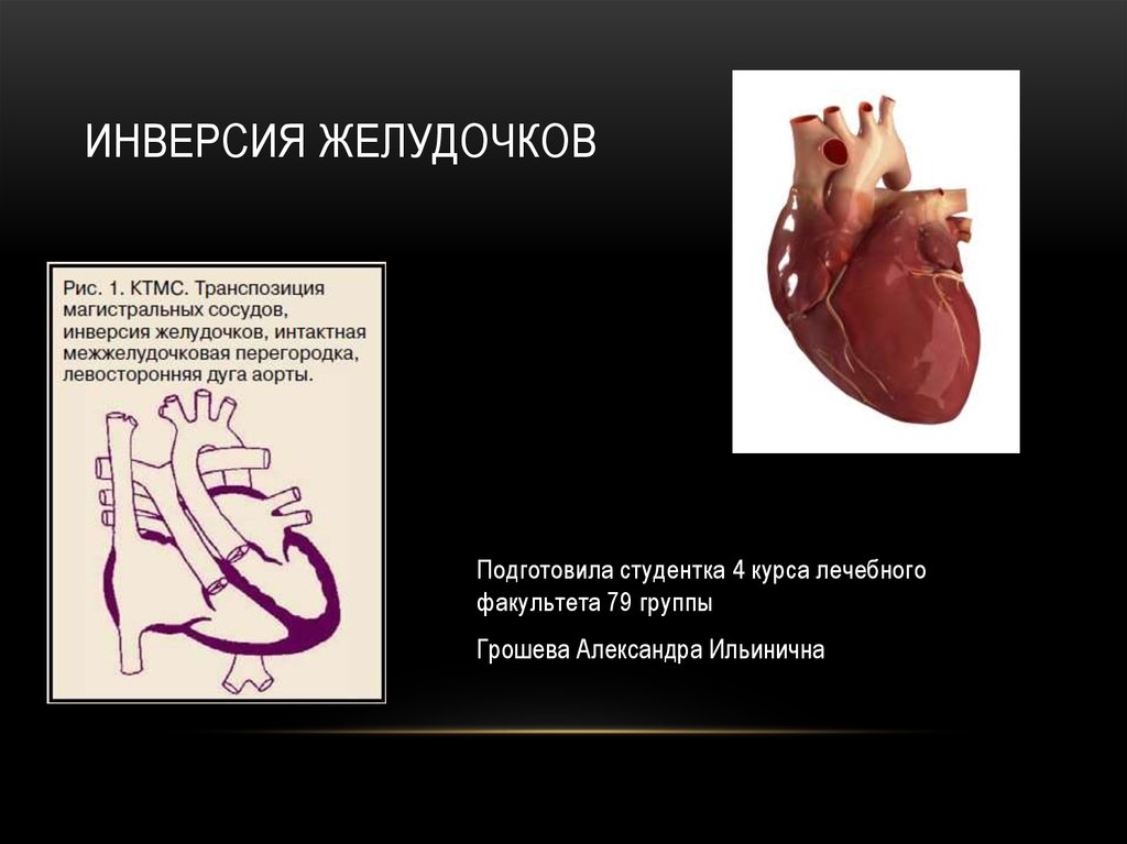 Инверсия картинки онлайн бесплатно