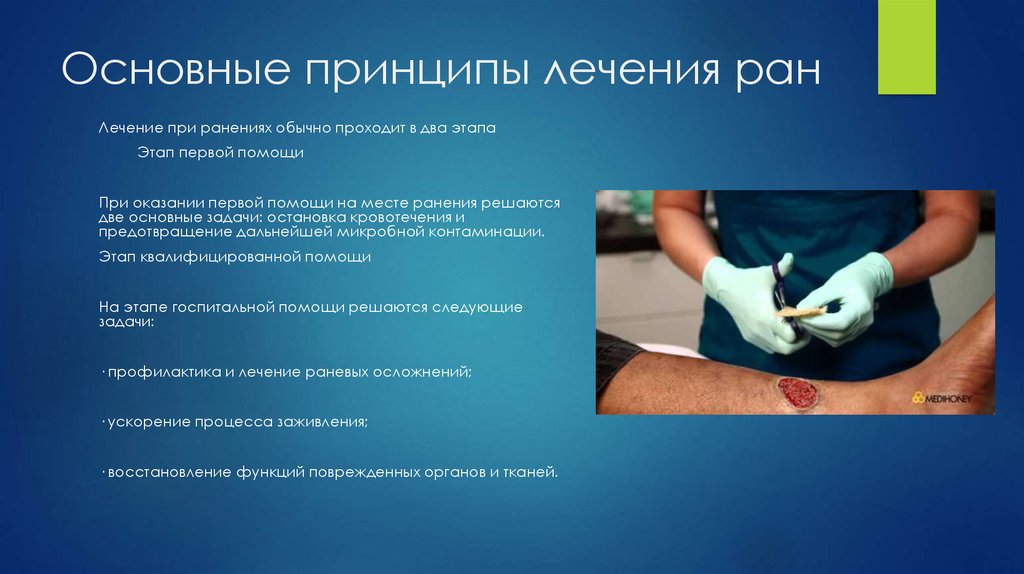 Основные принципы лечения ран