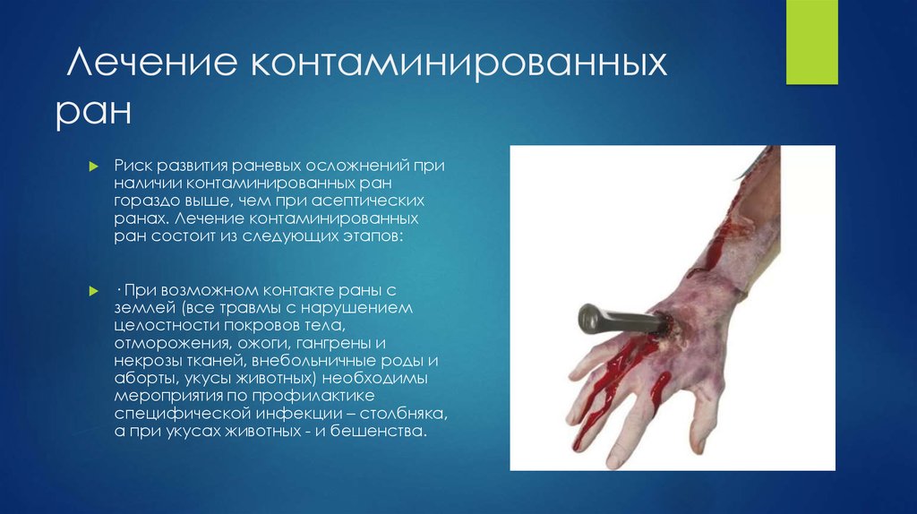 Лечение контаминированных ран