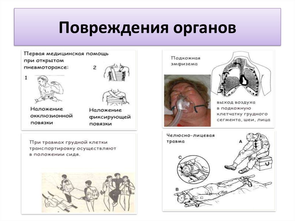 Травмы внутренних органов. Повреждение внутренних органов. Разрывы внутренних органов судебная медицина. Повреждение всех органов.