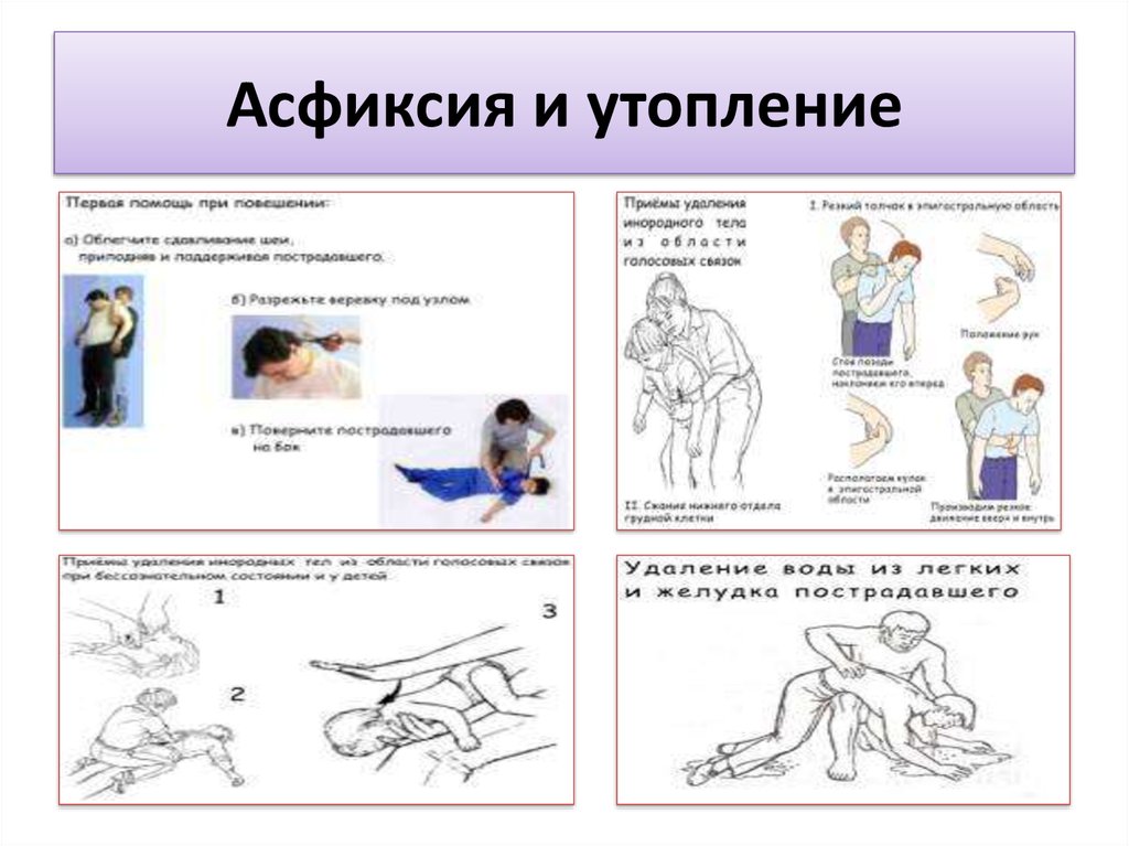 Механическая асфиксия помощь. Алгоритм при асфиксическом утоплении. Асфиксия при утоплении. Первая помощь при асфиксии утоплении. Первое мероприятие при асфиксическом утоплении:.