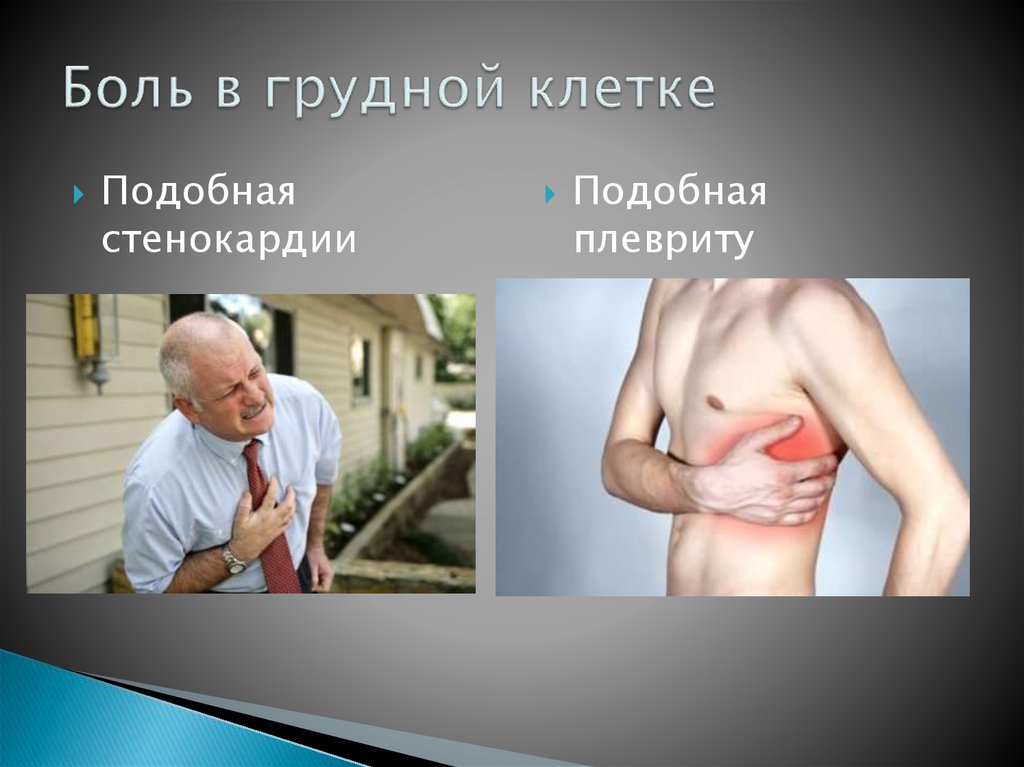 Боль в грудной клетке