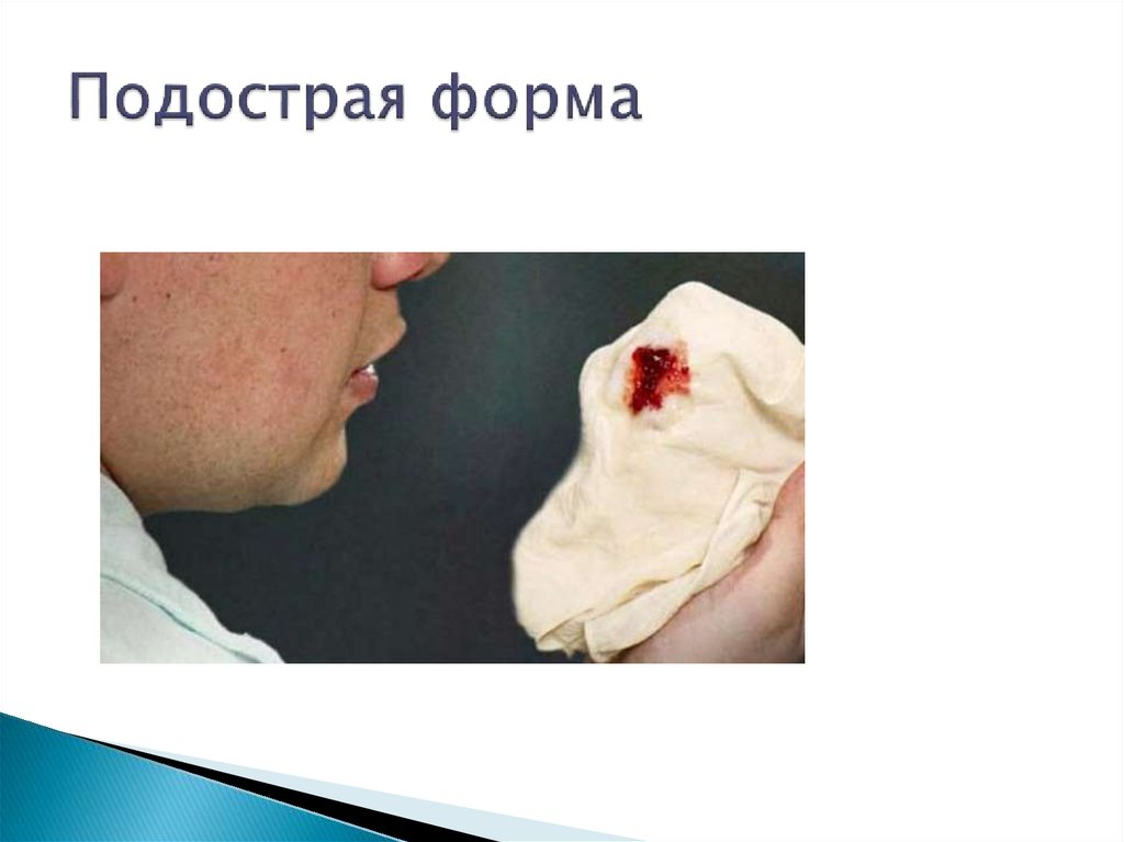 Подострая форма