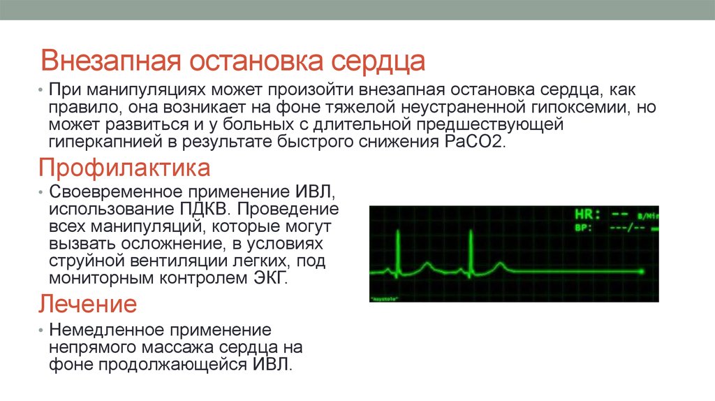 Останавливается ли