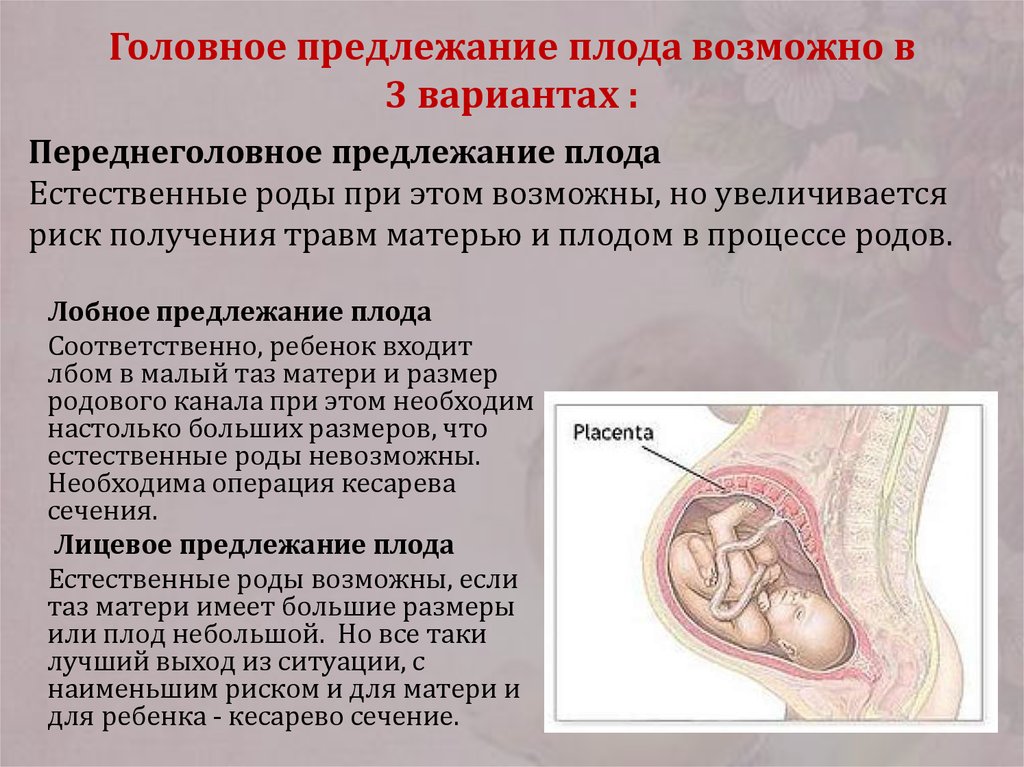 Беременность 39 недель признаки. Продольное расположение плода при беременности 30 недель. Головное предлежание плода при беременности на 30 неделе. Положение плода продольное предлежание головное. Головное продольное предлежание плода на 20 неделе беременности.