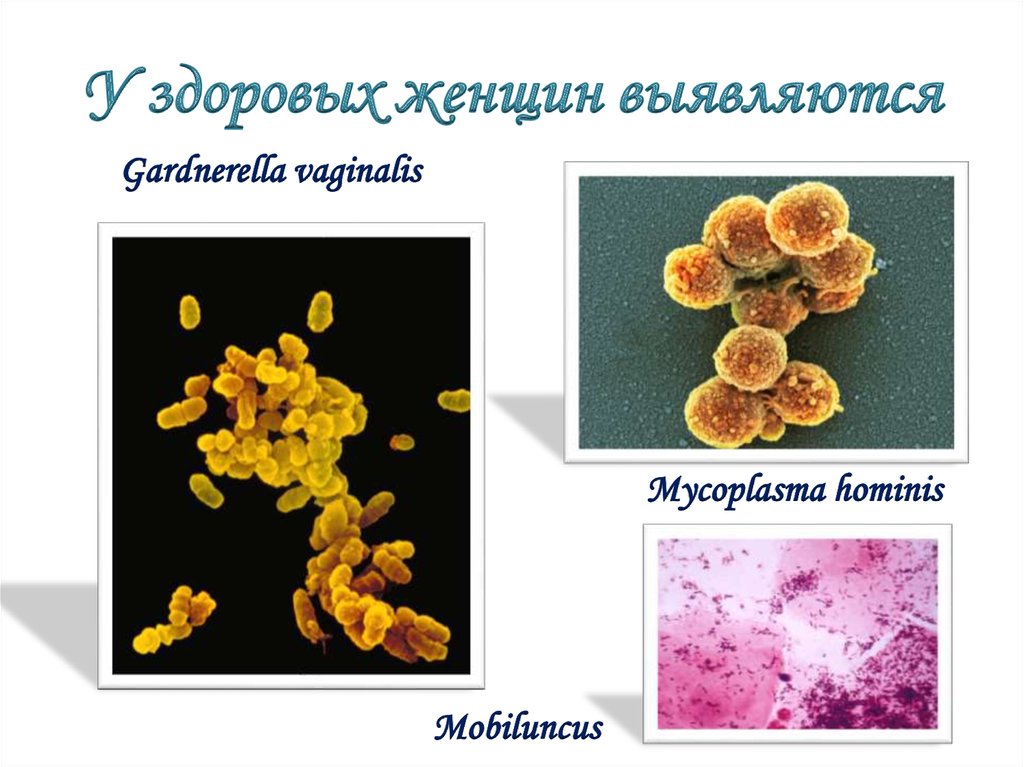 Gardnerella vaginālis у женщин. Микоплазма хоминис и гарднерелла. Гарднерелла микробиология. Gardnerella SP микробиология.