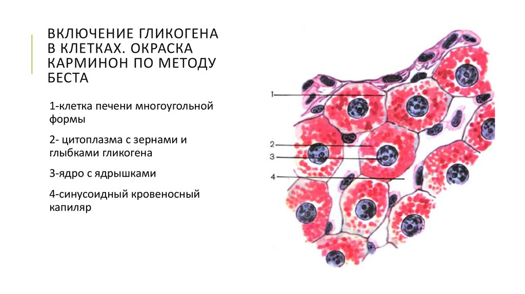 Доброкачественная гиперплазия (аденома) предстательной железы