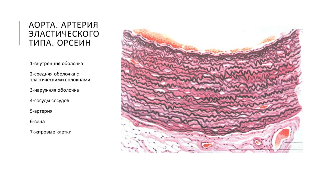 Артерия эластического типа схема