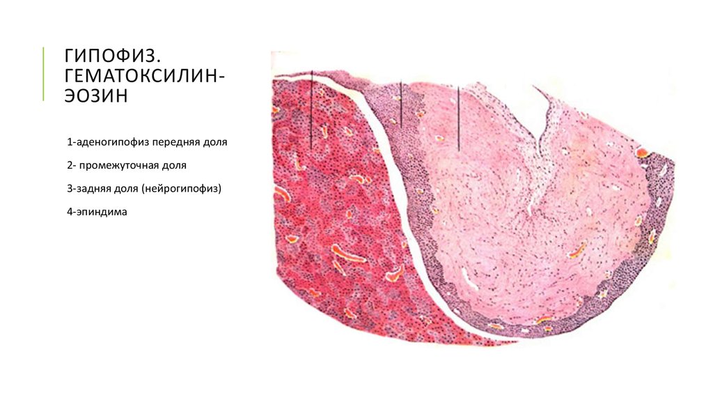 Гипофиз гистология рисунок