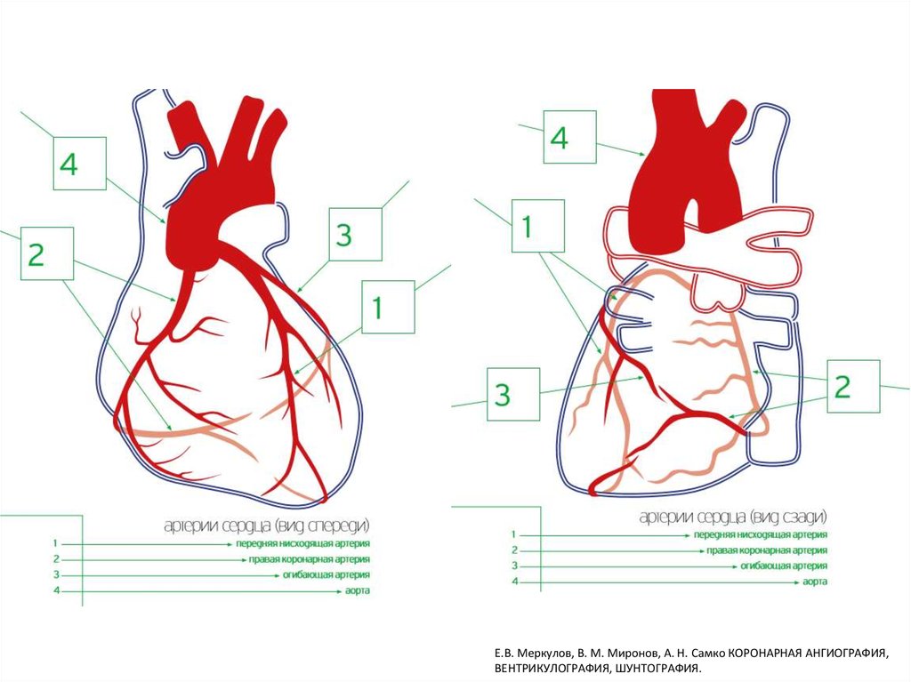 Сосуды сердца схема коронарография