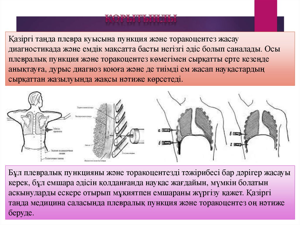 Плевральная пункция. Осложнения торакоцентеза плевральная пункция. Пункция плевральной полости (торакоцентез). Торакоцентез техника выполнения. Методика торакоцентеза.