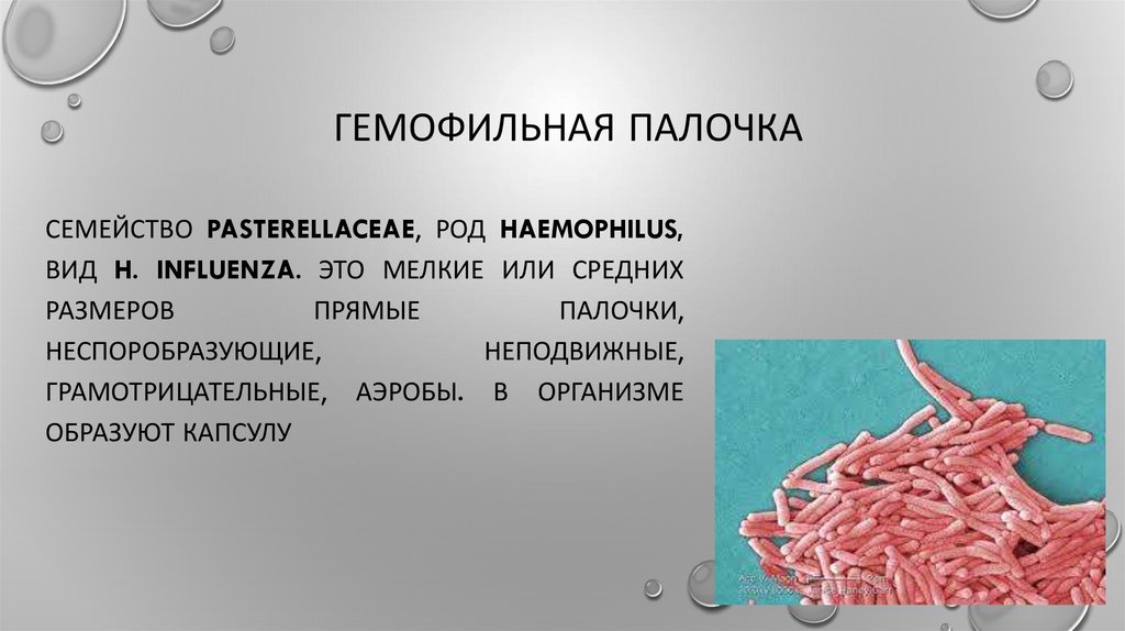 Haemophilus influenzae 10. Бактерий палочка гемофильная палочка. Бактерии Haemophilus influenzae. Гемофильная палочка возбудитель. Haemophilus influenzae (гемофильная палочка).