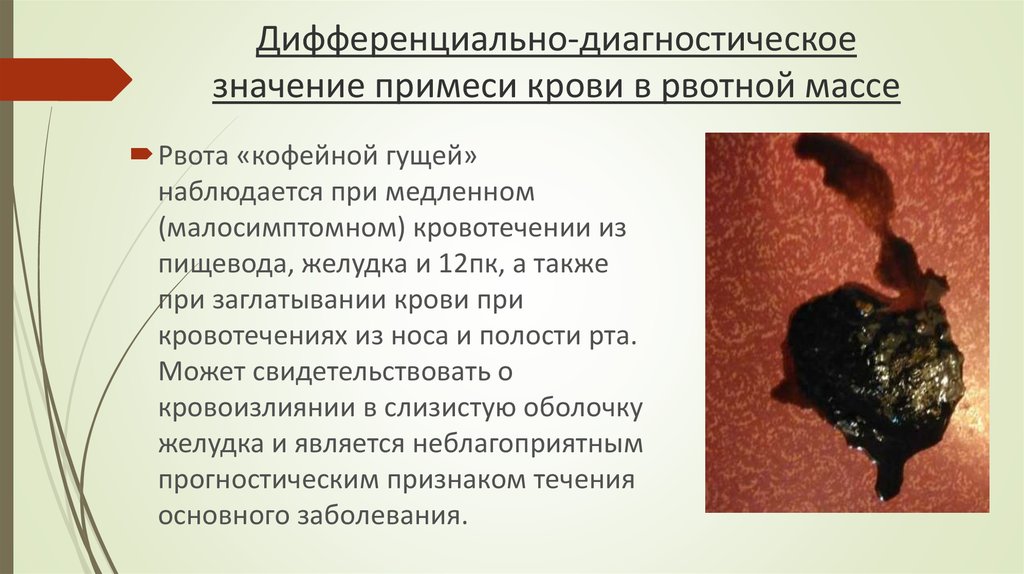 Дифференциально-диагностическое значение примеси крови в рвотной массе