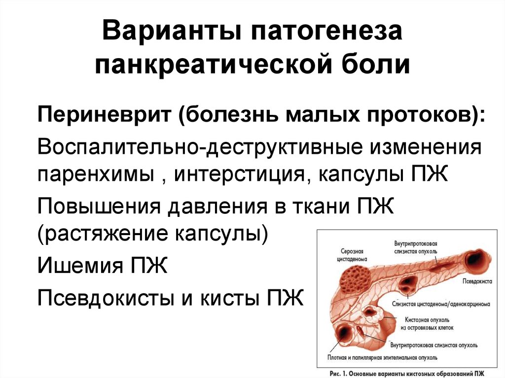 Изменения паренхимы. Опухоли поджелудочной железы патогенез. Паренхима поджелудочной железы. Варианты патогенеза.