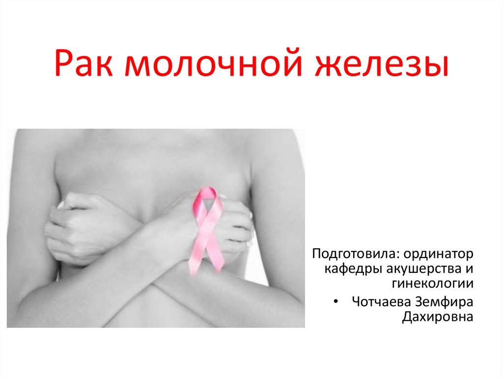 Рак молочной железы презентация онкология