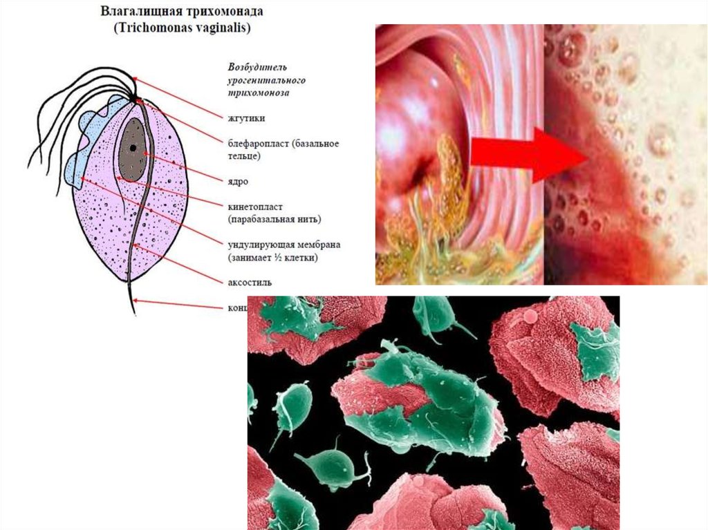 Трихомонада. Влагалищная трихомонада. Трихомонада презентация. Трихомонады питаются. Воспаление трихомонады.