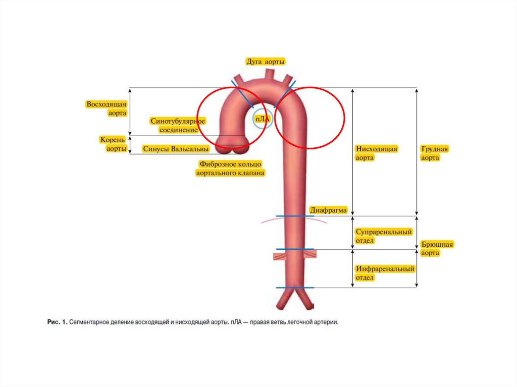 Нисходящая аорта норма