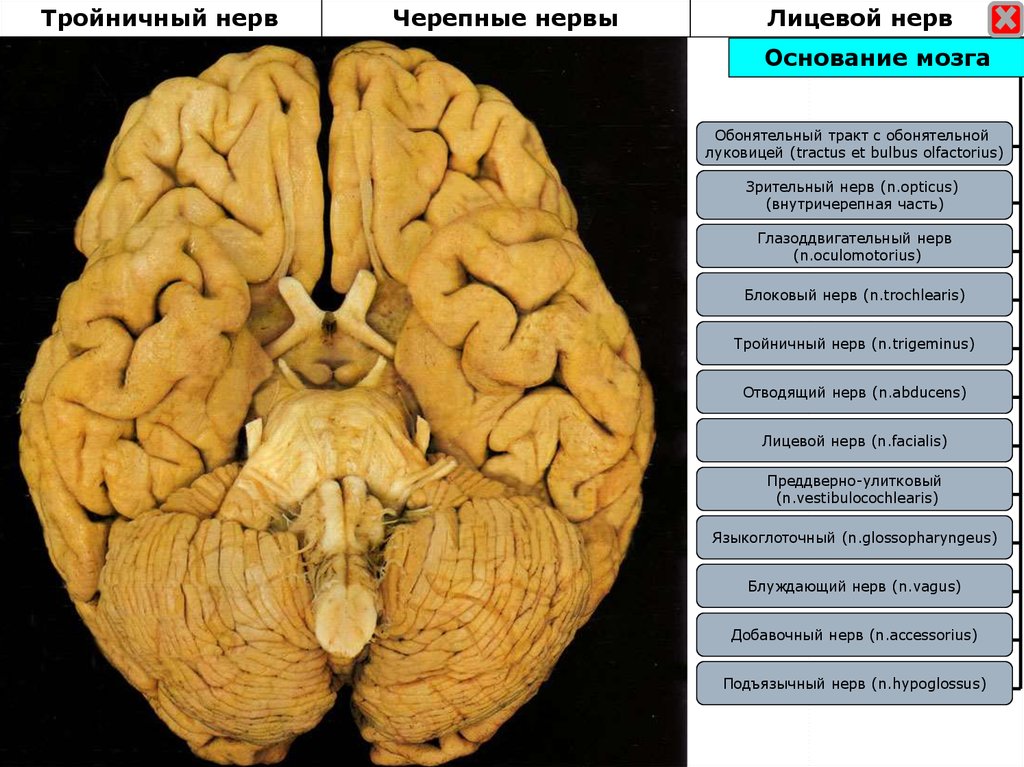 Основание мозга. Базальная поверхность головного мозга анатомия. Черепные нервы поверхность мозга. Вид головного мозга с базальной поверхности. Нижняя поверхность головного мозга анатомия.