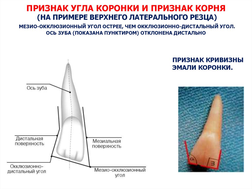 Признаки корня. Признак угла корня зубов. Признаки зубов кривизна коронки. Признак кривизны коронки зуба рисунок.