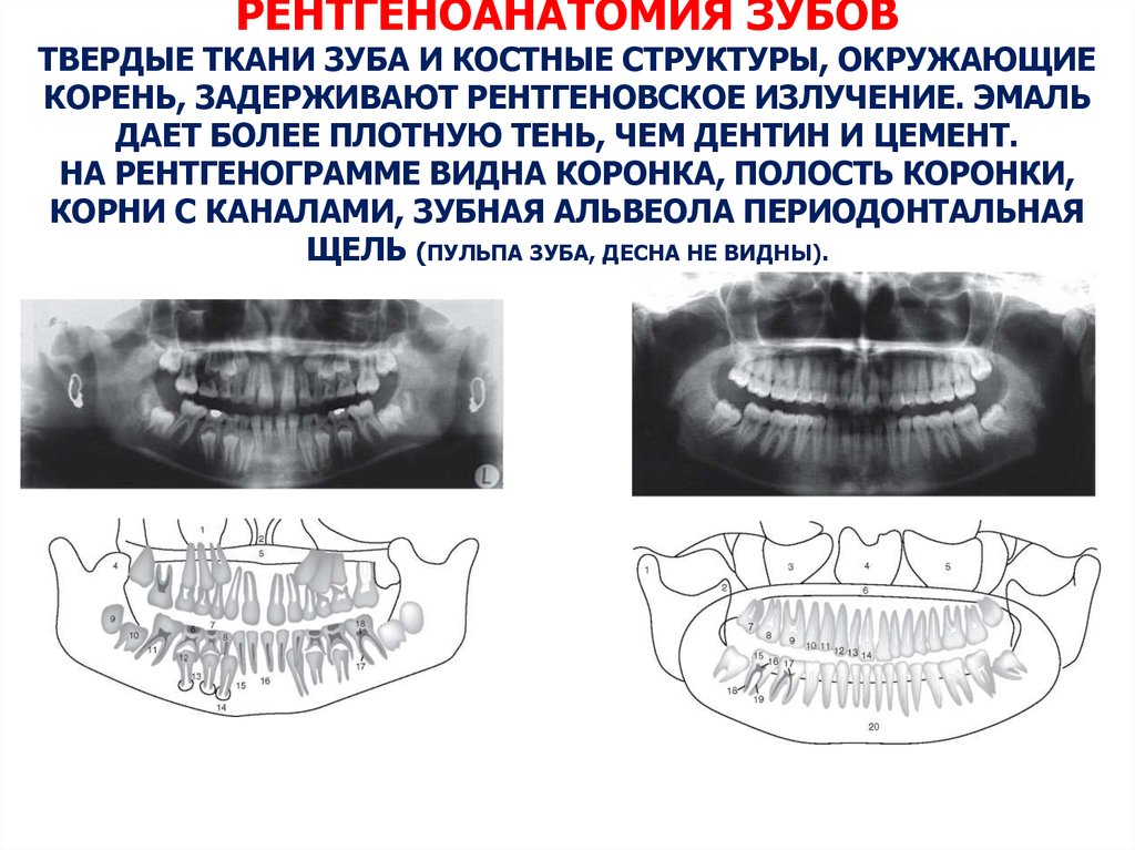 2 возрастные особенности изображения зубов и челюстей в норме на рентгенограммах