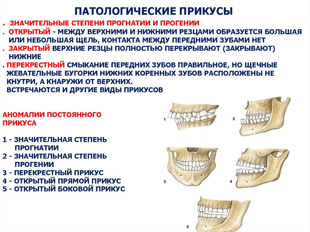 5 признаков зубов. Прикусы физиологические и патологические. Строение челюсти прогения прогнатия. Ортогнатический прикус резцы.