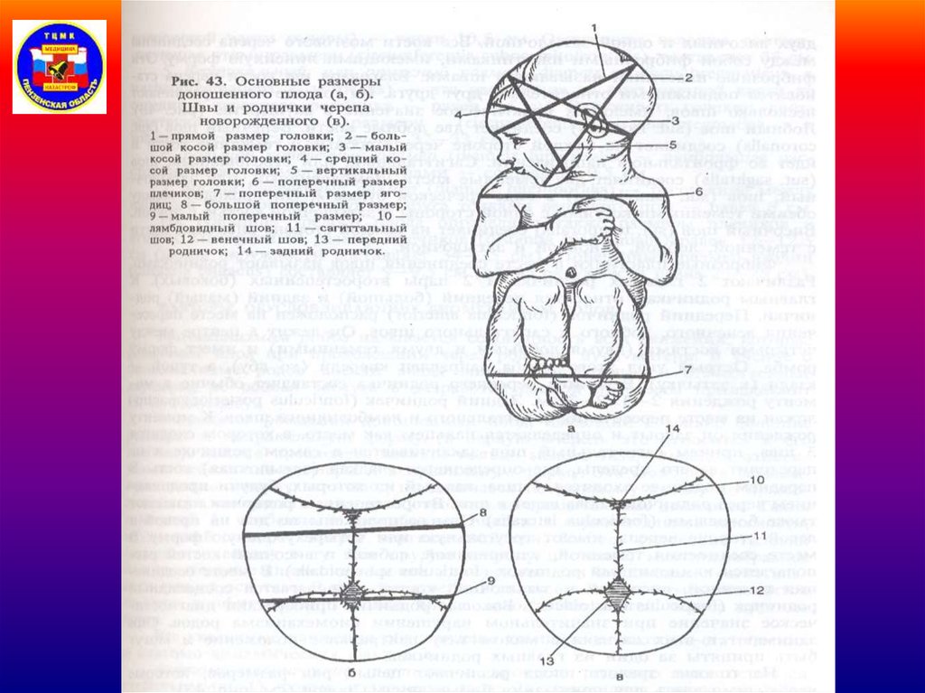 Размеры головки плода