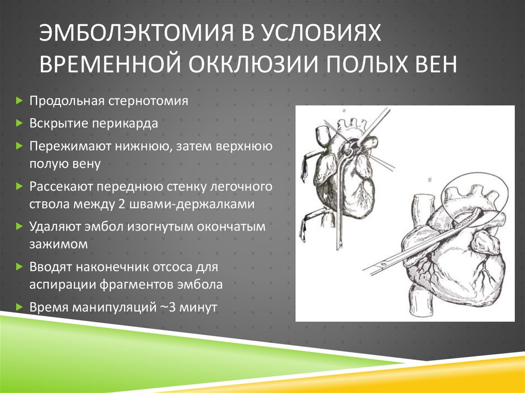 Острые тромбозы системы нижней полой вены презентация