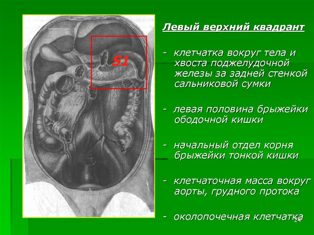 Верхней левой. Клетчатка брыжейки тонкой кишки уплотнена. Корень брыжейки тонкой кишки на кт. Блокада корня брыжейки. Корень брыжейки кт анатомия.