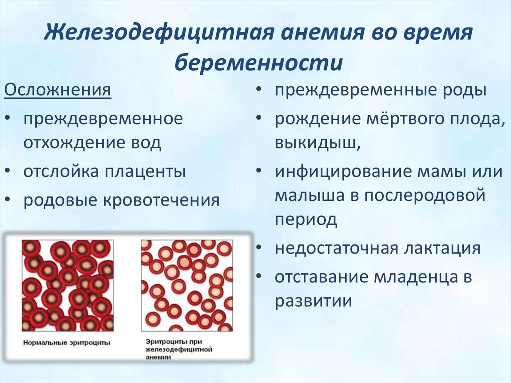 Анемия. Анемия осложняющая беременность. Осложнения железодефицитной анемии. Железодефицитная анемия при беременности. Железодефицитная анемия и б.