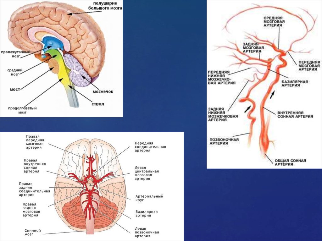 Инсульт правого бассейна. Бассейн задней мозговой артерии схема. Средняя мозговая артерия артерия. Бассейн левой средней мозговой артерии. Зоны кровоснабжения передней и средней мозговых артерий.
