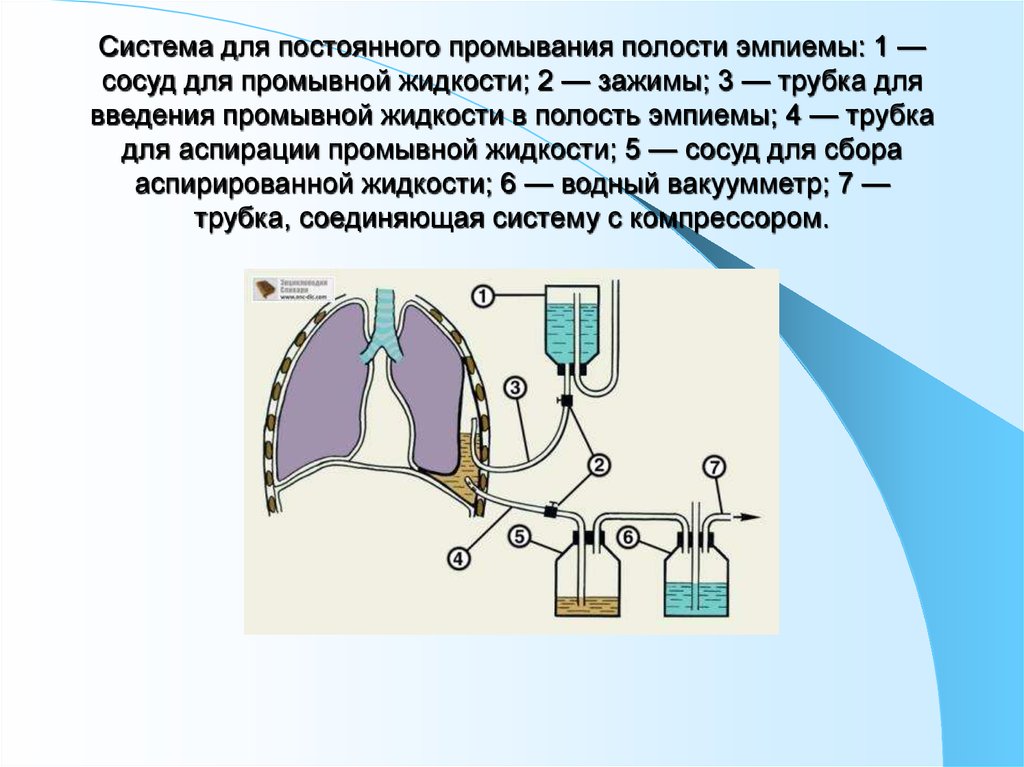 Жидкости полостей. Система для для постоянного промывания полости эмпиемы. Система для активной аспирации из полостей. Пассивная система аспирации.