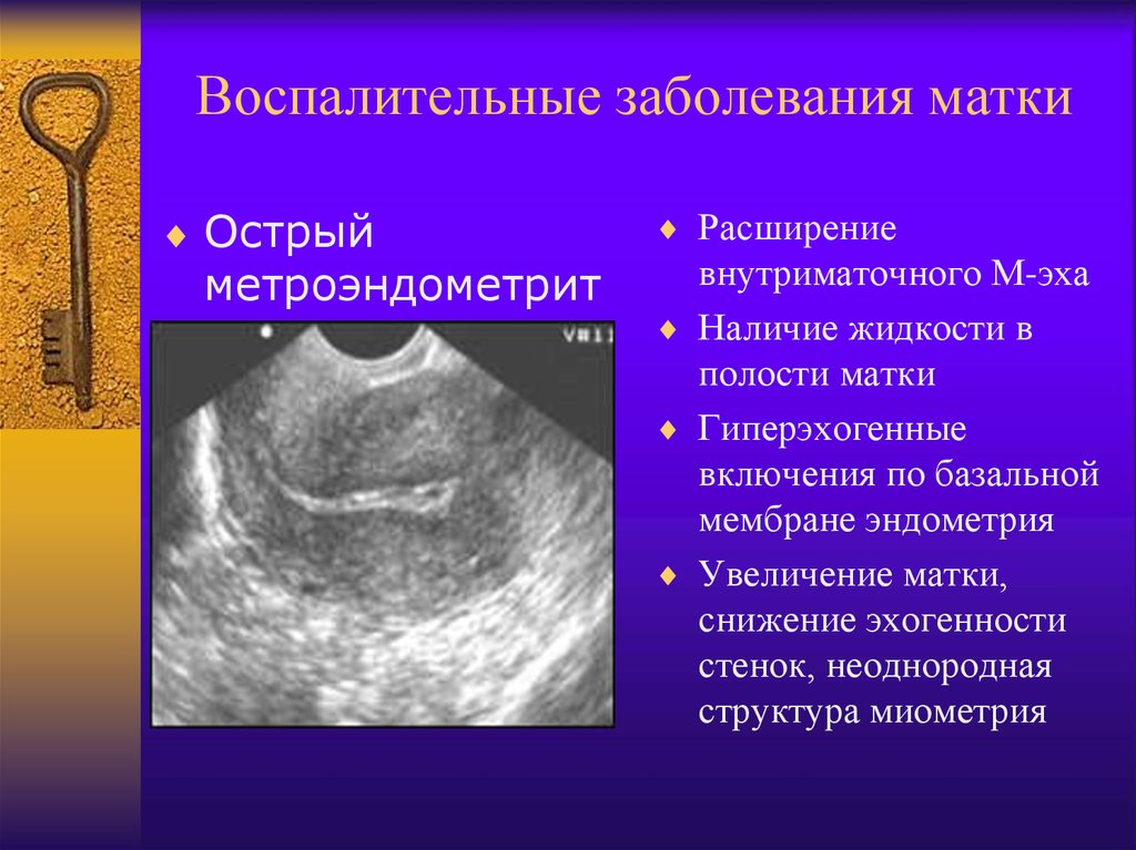 Эндометрия 16 мм. Воспалительные заболевания матки. Воспалительная болезнь матки. Хронический метроэндометрит на УЗИ. Воспалительные заболевания полости матки.