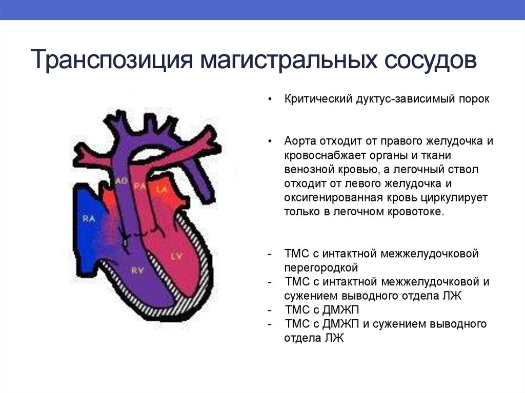 Транспозиция артерий. Врожденный порок сердца транспозиция магистральных артерий. Транспозиция магистральных сосудов гемодинамика. Транспозиция магистральных артерий у новорожденных. Простая транспозиция магистральных сосудов.