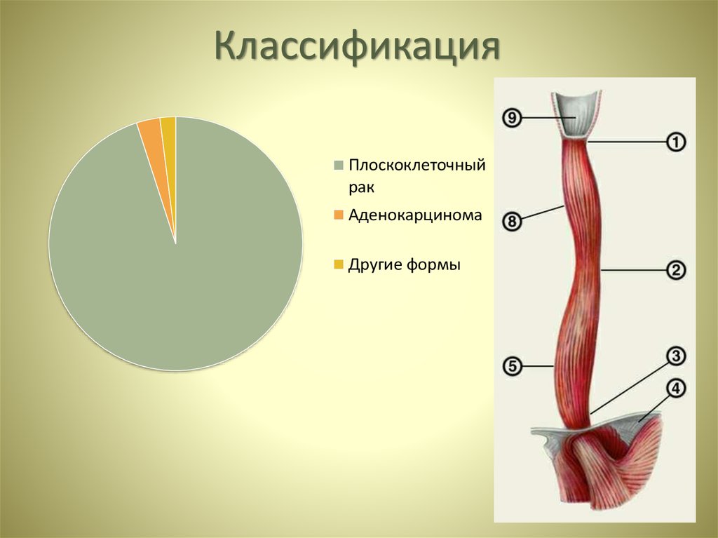 Классификация