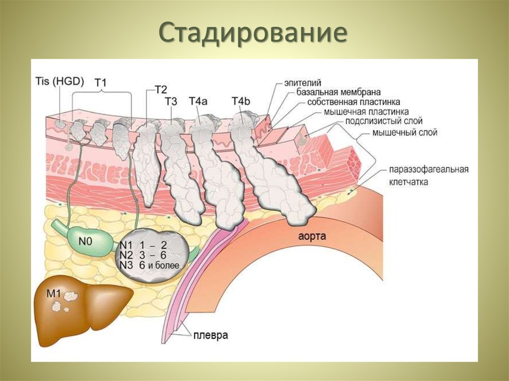 Стадирование