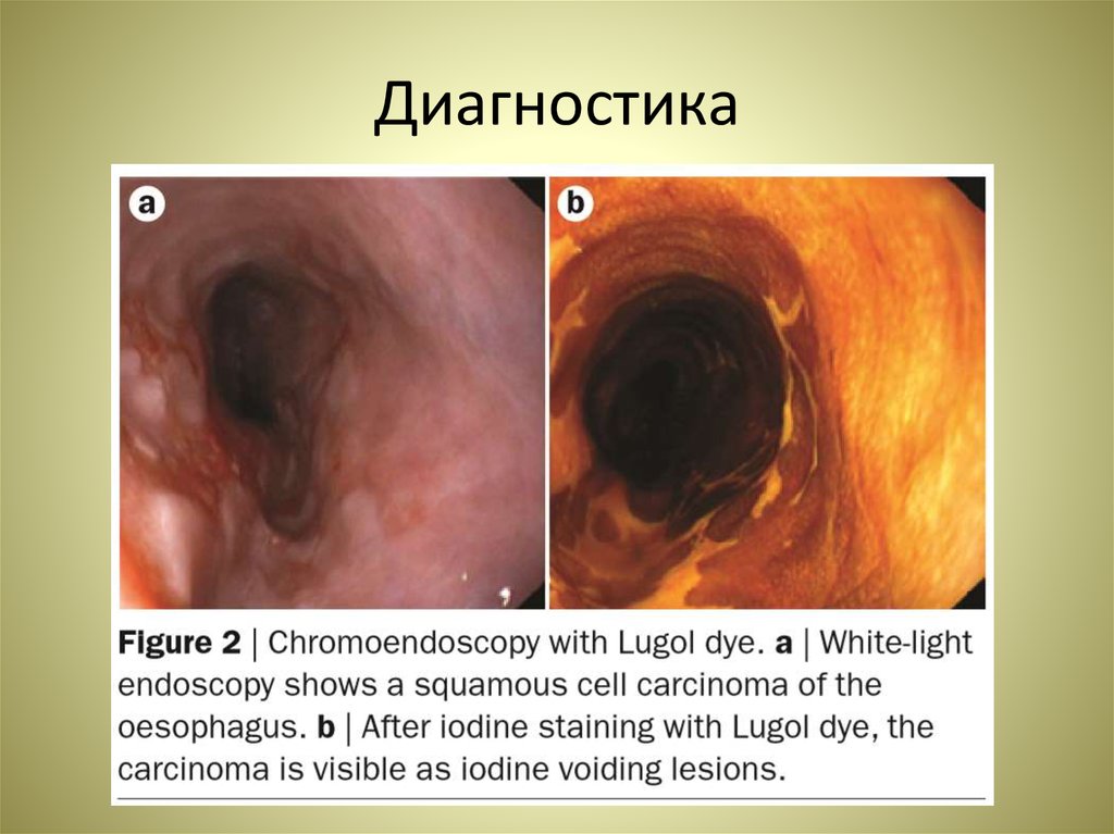 Диагностика