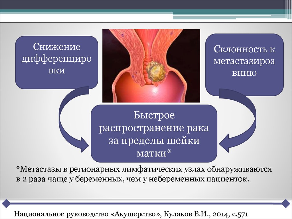 Онкология и беременность презентация