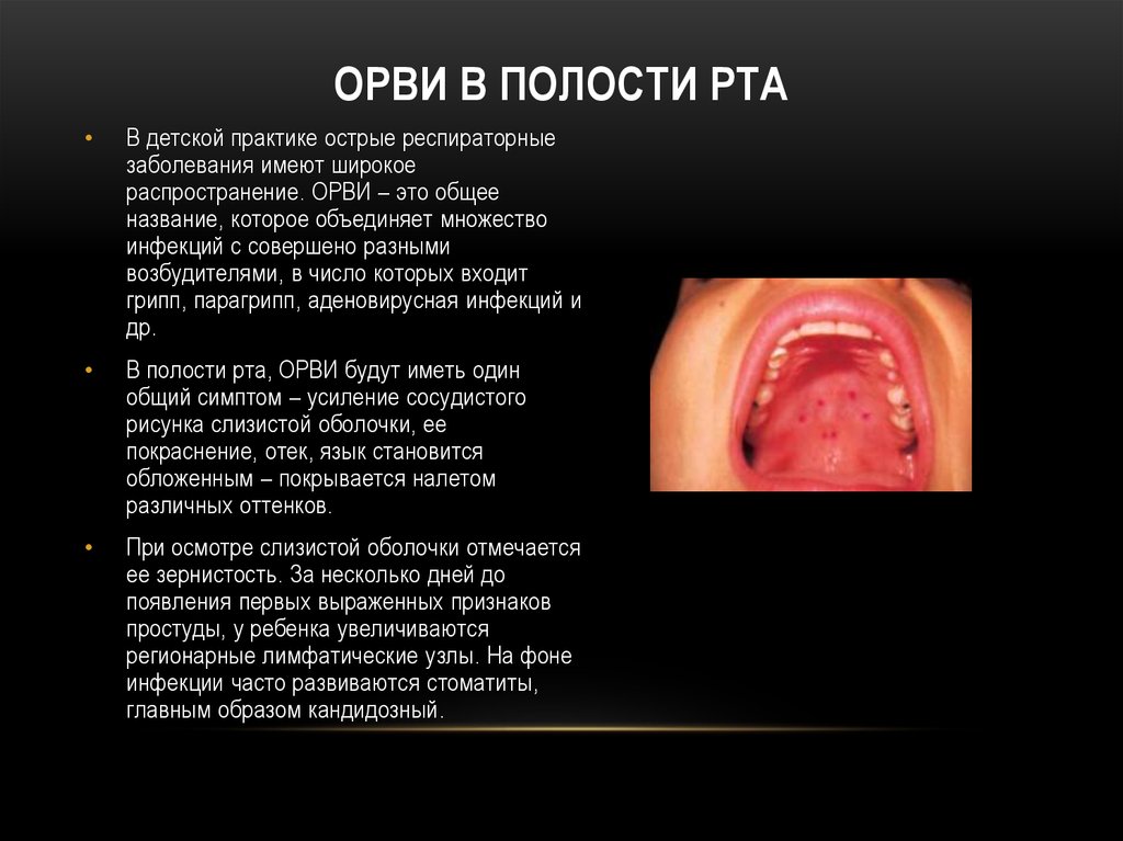 Рак слизистой полости рта фото симптомы