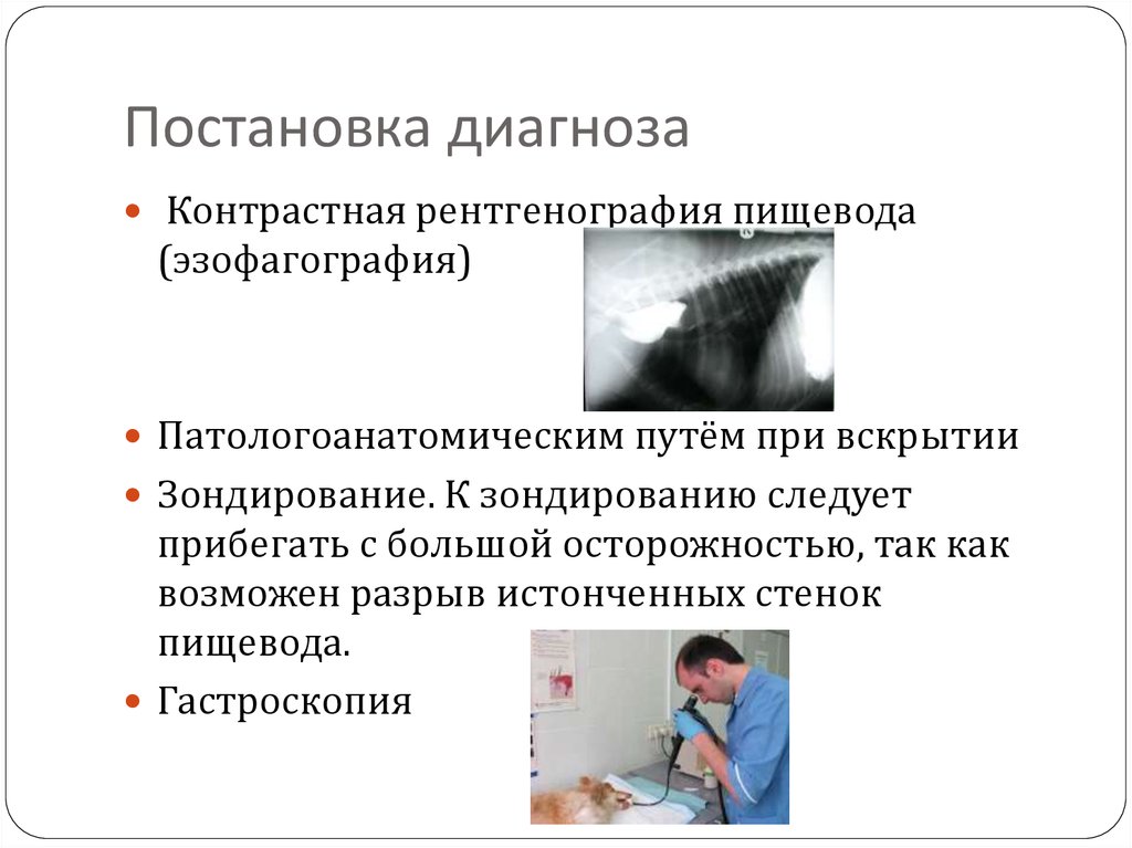 Постановка диагноза. Эзофагография пищевода. Рентген пищевода (эзофагография). Патологоанатомический диагноз при зондировании.