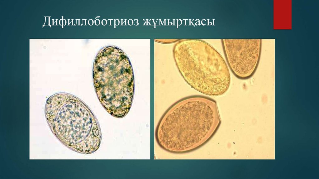 Лечение дифиллоботриоза