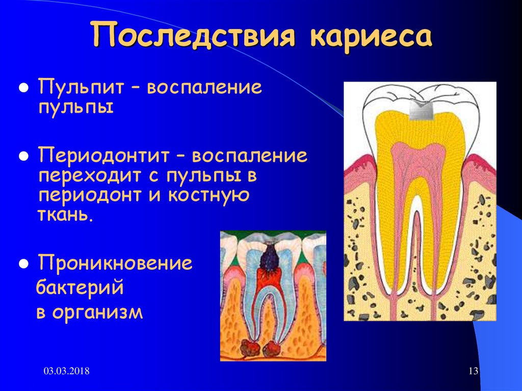 Проект по кариесу