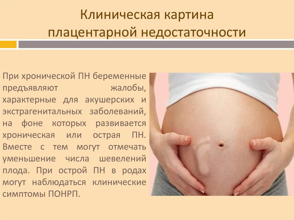 Насколько опасна беременность. Беременность плацентарная недостаточность. Клиническая картина плацентарной недостаточности. Плацентарная недостаточность при беременности симптомы. Плацентарная недостаточность клиника.